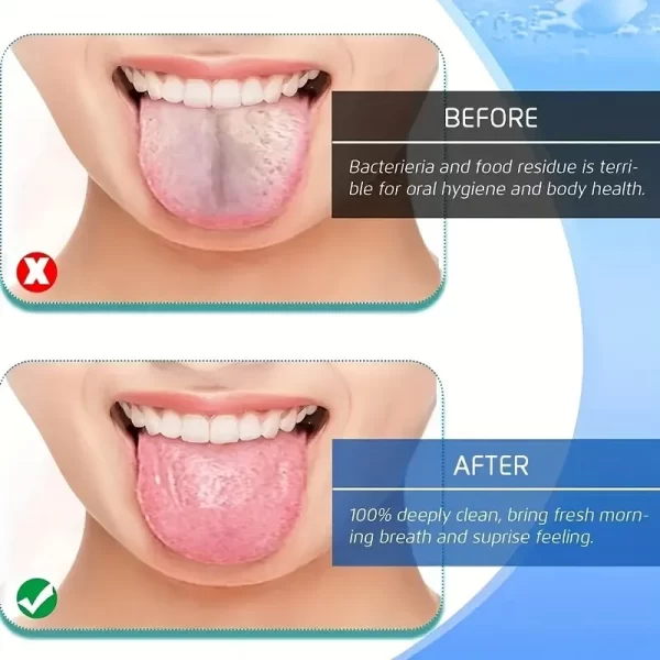 Stainless Steel Tongue Scraper Before and After